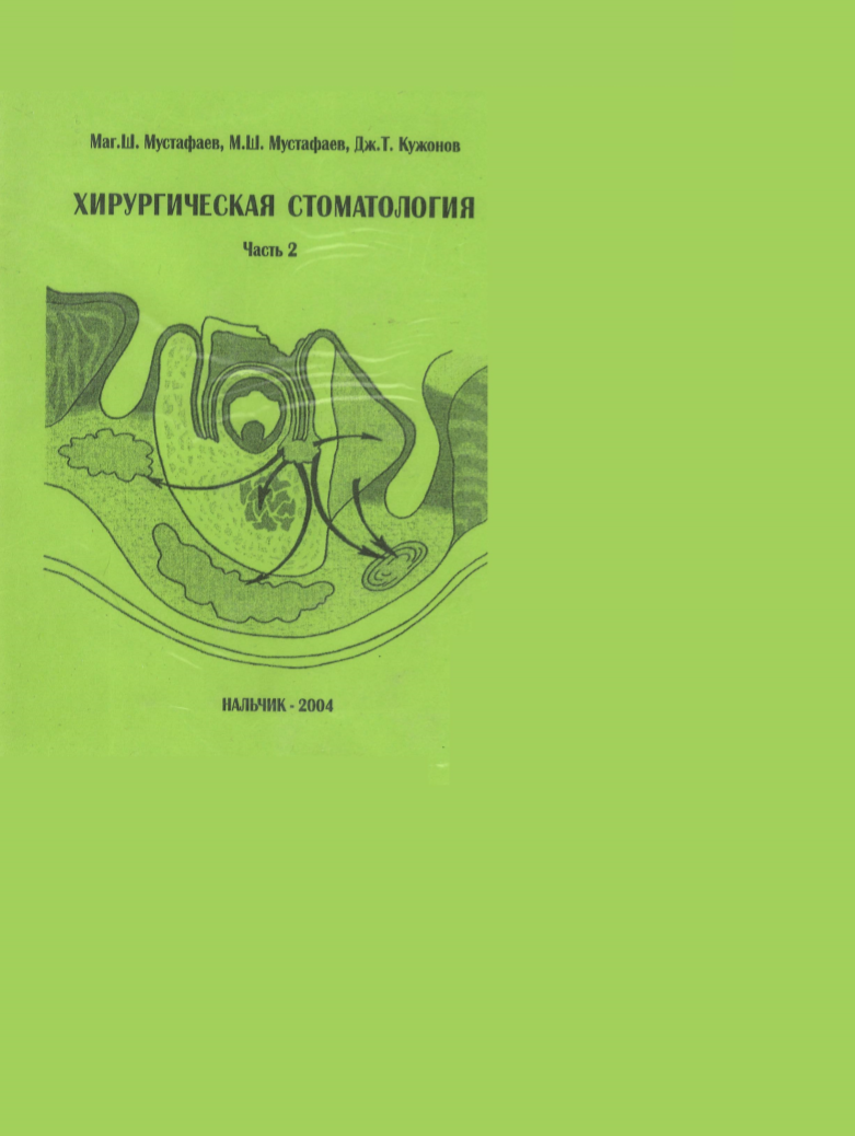 144
